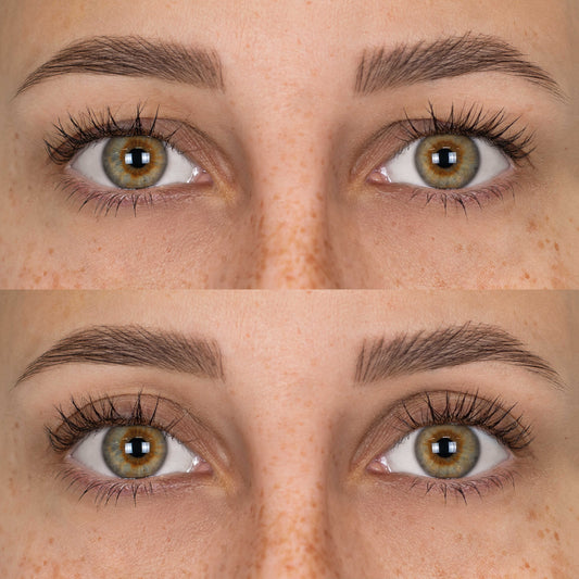 Patchs Lift Paupières